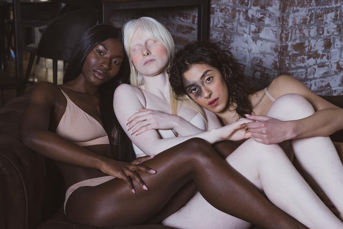 Il potere dell’imperfezione: Come la diversità fa progredire la moda in questa agenzia